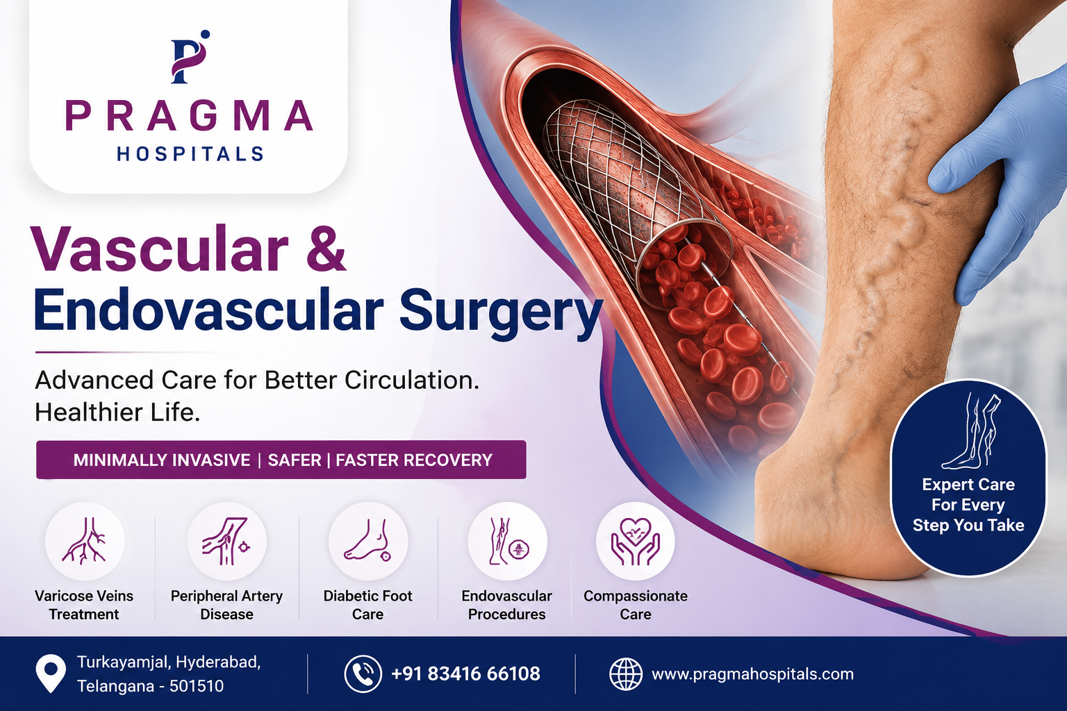 Vascular and Endovascular Surgery in Hyderabad